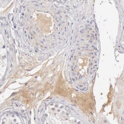 Invitrogen Complement Factor I Polyclonal Antibody 100 &mu;L; Unconjugated:Antibodies,
