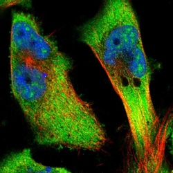 Invitrogen CKAP4 Polyclonal Antibody 100 &mu;L; Unconjugated:Antibodies,