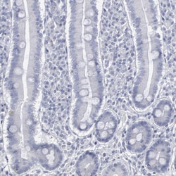 Invitrogen DMC1 Polyclonal Antibody 100 &mu;L; Unconjugated:Antibodies,
