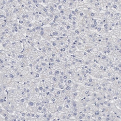 Invitrogen DMC1 Polyclonal Antibody 100 &mu;L; Unconjugated:Antibodies,