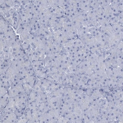 Invitrogen DMC1 Polyclonal Antibody 100 &mu;L; Unconjugated:Antibodies,