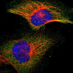 Invitrogen IKK beta Polyclonal Antibody 100 &mu;L; Unconjugated:Antibodies,