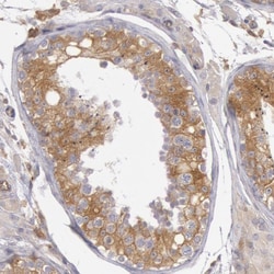 Invitrogen IKK beta Polyclonal Antibody 100 &mu;L; Unconjugated:Antibodies,
