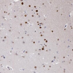 Invitrogen MSK1 Polyclonal Antibody 100 &mu;L; Unconjugated:Antibodies,