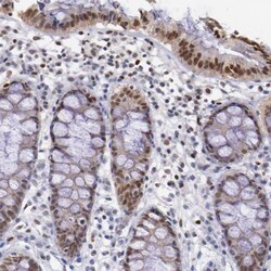 Invitrogen MSK1 Polyclonal Antibody 100 &mu;L; Unconjugated:Antibodies,