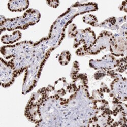Invitrogen MSK1 Polyclonal Antibody 100 &mu;L; Unconjugated:Antibodies,