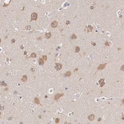 Invitrogen HDJ2 Polyclonal Antibody 100 &mu;L; Unconjugated:Antibodies,