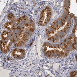 Invitrogen HDJ2 Polyclonal Antibody 100 &mu;L; Unconjugated:Antibodies,