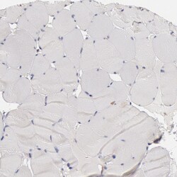 Invitrogen HDJ2 Polyclonal Antibody 100 &mu;L; Unconjugated:Antibodies,