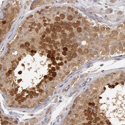 Invitrogen HDJ2 Polyclonal Antibody 100 &mu;L; Unconjugated:Antibodies,