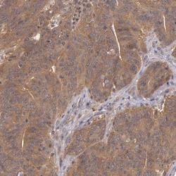 Invitrogen B-Raf Polyclonal Antibody 100 &mu;L; Unconjugated:Antibodies,