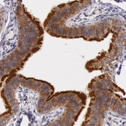 Invitrogen PCTAIRE1 Polyclonal Antibody 100 &mu;L; Unconjugated:Antibodies,