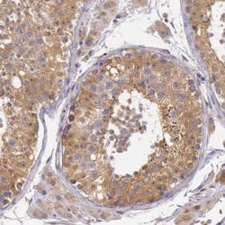 Invitrogen PCTAIRE1 Polyclonal Antibody 100 &mu;L; Unconjugated:Antibodies,