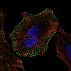 Invitrogen H-cadherin Polyclonal Antibody 100 &mu;L; Unconjugated:Antibodies,