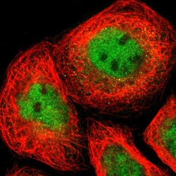 Invitrogen IKK alpha Polyclonal Antibody 100 &mu;L; Unconjugated:Antibodies,