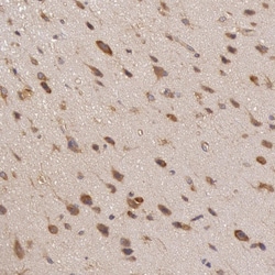 Invitrogen IKK alpha Polyclonal Antibody 100 &mu;L; Unconjugated:Antibodies,