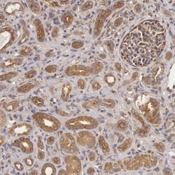 Invitrogen IKK alpha Polyclonal Antibody 100 &mu;L; Unconjugated:Antibodies,