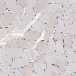 Invitrogen IKK alpha Polyclonal Antibody 100 &mu;L; Unconjugated:Antibodies,