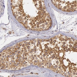 Invitrogen IKK alpha Polyclonal Antibody 100 &mu;L; Unconjugated:Antibodies,