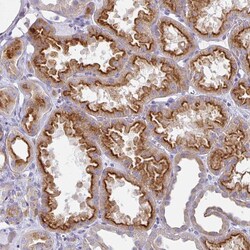 Invitrogen STX7 Polyclonal Antibody 100 &mu;L; Unconjugated:Antibodies,