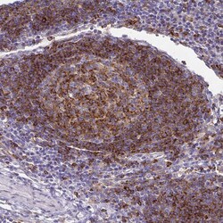 Invitrogen STX7 Polyclonal Antibody 100 &mu;L; Unconjugated:Antibodies,