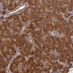 Invitrogen ECE1 Polyclonal Antibody 100 &mu;L; Unconjugated:Antibodies,