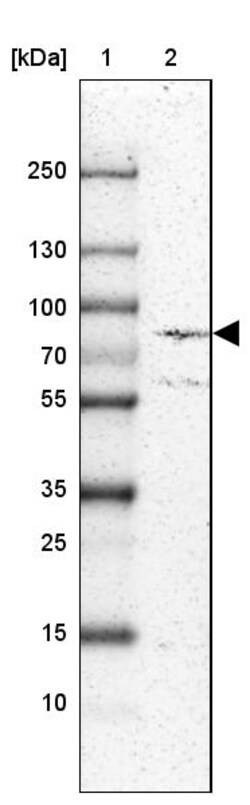 Invitrogen ECE1 Polyclonal Antibody 100 &mu;L; Unconjugated:Anticuerpos