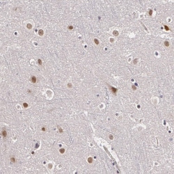 Invitrogen PLZF Polyclonal Antibody 100 &mu;L; Unconjugated:Antibodies,