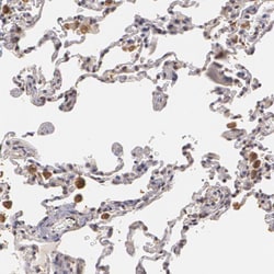 Invitrogen PLZF Polyclonal Antibody 100 &mu;L; Unconjugated:Antibodies,