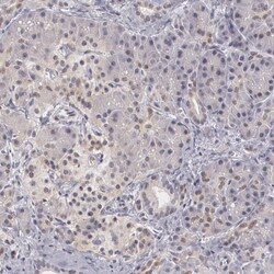 Invitrogen PLZF Polyclonal Antibody 100 &mu;L; Unconjugated:Antibodies,