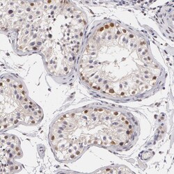 Invitrogen PLZF Polyclonal Antibody 100 &mu;L; Unconjugated:Antibodies,