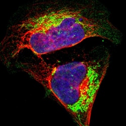 Invitrogen ATP Synthase beta Polyclonal Antibody 100 &mu;L; Unconjugated:Antibodies,