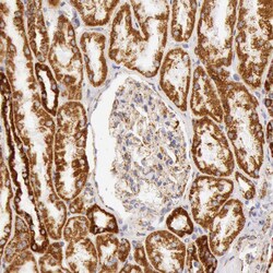 Invitrogen ATP Synthase beta Polyclonal Antibody 100 &mu;L; Unconjugated:Antibodies,
