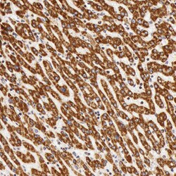 Invitrogen ATP Synthase beta Polyclonal Antibody 100 &mu;L; Unconjugated:Antibodies,