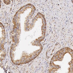 Invitrogen ATP Synthase beta Polyclonal Antibody 100 &mu;L; Unconjugated:Antibodies,