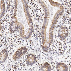 Invitrogen ATP Synthase beta Polyclonal Antibody 100 &mu;L; Unconjugated:Antibodies,