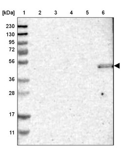 Invitrogen ZNF350 Polyclonal Antibody 100 &mu;L; Unconjugated:Antibodies,