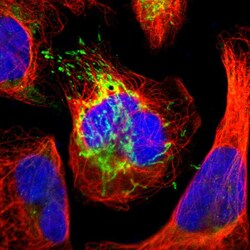 Invitrogen ATP Synthase beta Polyclonal Antibody 100 &mu;L; Unconjugated:Antibodies,