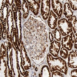 Invitrogen ATP Synthase beta Polyclonal Antibody 100 &mu;L; Unconjugated:Antibodies,