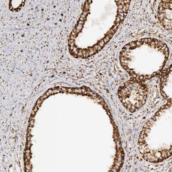 Invitrogen ATP Synthase beta Polyclonal Antibody 100 &mu;L; Unconjugated:Antibodies,