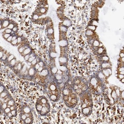 Invitrogen ATP Synthase beta Polyclonal Antibody 100 &mu;L; Unconjugated:Antibodies,