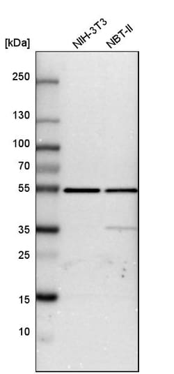 Invitrogen ATP Synthase beta Polyclonal Antibody 100 &mu;L | Buy Online | Invitrogen&trade; | Fisher Scientific
