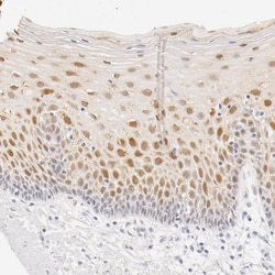 Invitrogen Galectin 7 Polyclonal Antibody 100 &mu;L; Unconjugated:Antibodies,