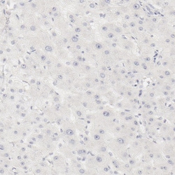 Invitrogen Galectin 7 Polyclonal Antibody 100 &mu;L; Unconjugated:Antibodies,