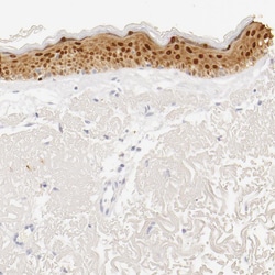 Invitrogen Galectin 7 Polyclonal Antibody 100 &mu;L; Unconjugated:Antibodies,