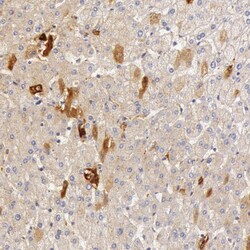 Invitrogen C4BPA Polyclonal Antibody 100 &mu;L | Buy Online | Invitrogen&trade; | Fisher Scientific