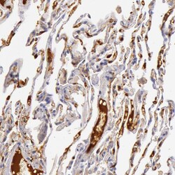 Invitrogen C4BPA Polyclonal Antibody 100 &mu;L | Buy Online | Invitrogen&trade; | Fisher Scientific