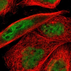 Invitrogen ELK3 Polyclonal Antibody 100 &mu;L; Unconjugated:Antibodies,