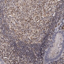 Invitrogen ELK3 Polyclonal Antibody 100 &mu;L; Unconjugated:Antibodies,