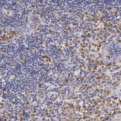 Invitrogen TLR8 Polyclonal Antibody 100 &mu;L; Unconjugated:Antibodies,